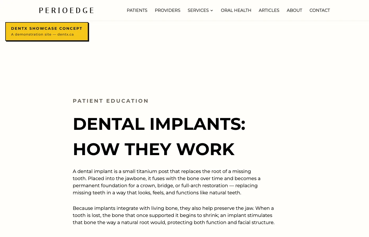 PerioEdge dental-implants page screenshot